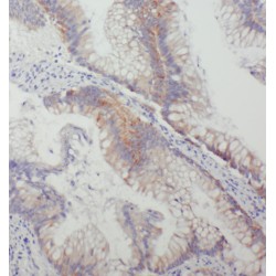 Thimet Oligopeptidase (THOP1) Antibody