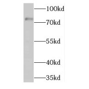 WB analysis of human placenta tissue, using THOP1 antibody (1/500 dilution).