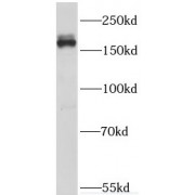 WB analysis of C6 cells, using Thrombospondin 1 antibody (1/1000 dilution).