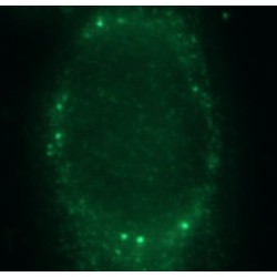 Thyroid Hormone Responsive (THRSP) Antibody