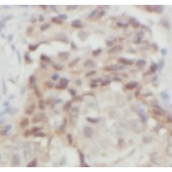 Thyroid Hormone Responsive (THRSP) Antibody