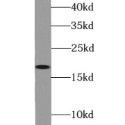 WB analysis of mouse liver tissue, using THRSP antibody (1/1000 dilution).