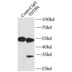 Thiamine-Triphosphatase (THTPA) Antibody