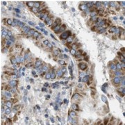 IHC-P analysis of human thyroid tissue, using Thyroglobulin antibody (1/200 dilution).