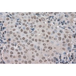 TGFB1-Induced Anti-Apoptotic Factor 1 (TIAF1) Antibody