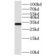 WB analysis of PC-3 cells, using TICAM2 antibody (1/500 dilution).