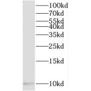 WB analysis of human heart tissue, using TIMM10 antibody (1/500 dilution).