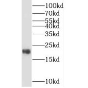 WB analysis of HepG2 cells, using TIMM22 antibody (1/1000 dilution).