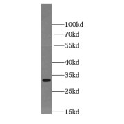 WB analysis of A375 cells, using TIMMDC1 antibody (1/1000 dilution).