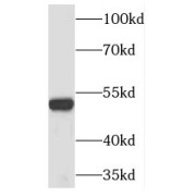 WB analysis of mouse spleen tissue, using TIN2 antibody (1/200 dilution).