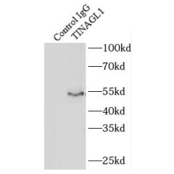 Tubulointerstitial Nephritis Antigen-Like (TINAGL1) Antibody