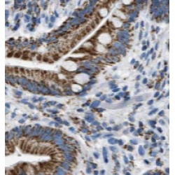 TINAG-Specific Antibody