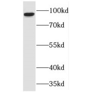 WB analysis of human skeletal muscle tissue, using TJAP1 antibody (1/1500 dilution).