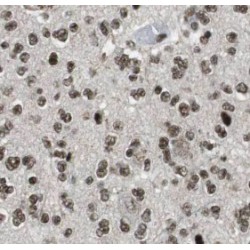 Transducin-Like Enhancer Protein 1 (TLE1) Antibody