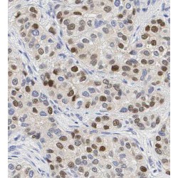 Transducin-Like Enhancer Protein 3 (TLE3) Antibody