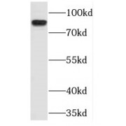 WB analysis of HeLa cells, using TLK1 antibody (1/500 dilution).