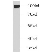 WB analysis of RAW 264.7 cells, using TLR6 antibody (1/1000 dilution).