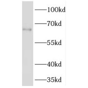 WB analysis of mouse kidney tissue, using TM7SF3 antibody (1/1000 dilution).