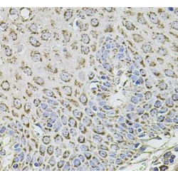 Transmembrane Channel-Like Protein 1 (TMC1) Antibody