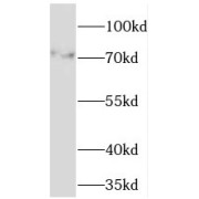 WB analysis of human skeletal muscle tissue, using TMCC1 antibody (1/500 dilution).