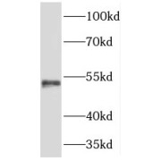 WB analysis of human testis tissue, using TMCO6 antibody (1/500 dilution).