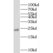 WB analysis of mouse pancreas tissue, using TMED2 antibody (1/500 dilution).