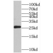 WB analysis of mouse liver tissue, using TMED9 antibody (1/500 dilution).