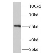 WB analysis of HepG2 cells, using TMEM102 antibody (1/1000 dilution).