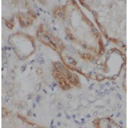 IHC-P analysis of human kidney tissue, using TMEM154 antibody (1/50 dilution).