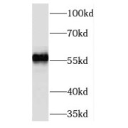 WB analysis of HEK-293 cells, using TMEM161A antibody (1/1000 dilution).