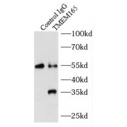 Transmembrane Protein 165 (TMEM165) Antibody