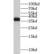 WB analysis of Jurkat cells, using TMEM165 antibody (1/3000 dilution).