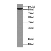 WB analysis of A431 cells, using TMEM181 antibody (1/300 dilution).