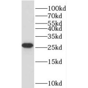 WB analysis of mouse brain tissue, using TMEM208 antibody (1/300 dilution).