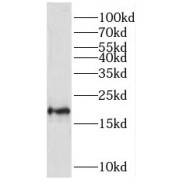 WB analysis of mouse cerebellum tissue, using TMEM35 antibody (1/600 dilution).