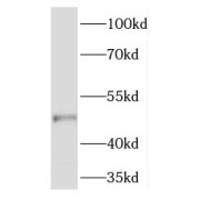 WB analysis of mouse ovary tissue, using TMEM5 antibody (1/300 dilution).