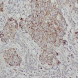 Transmembrane Protein 59 (TMEM59) Antibody