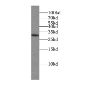 WB analysis of K-562 cells, using TMEM77 antibody (1/600 dilution).