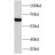 WB analysis of MDA-MB-453s cells, using TMEM87A antibody (1/300 dilution).