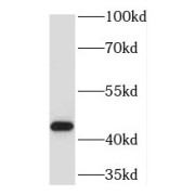 WB analysis of human liver tissue, using TMLHE antibody (1/500 dilution).