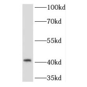 WB analysis of mouse skeletal muscle tissue, using TMOD1 antibody (1/600 dilution).