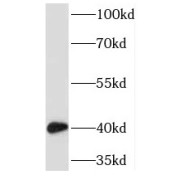 WB analysis of human testis tissue, using TMOD2 antibody (1/400 dilution).