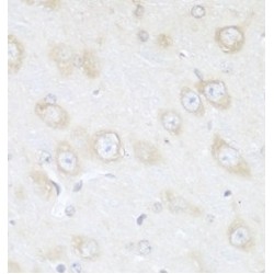 Tropomodulin-3 (TMOD3) Antibody