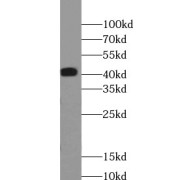 WB analysis of MCF7 cells, using TMOD3 antibody (1/1000 dilution).