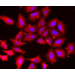 Tropomodulin-4 (TMOD4) Antibody