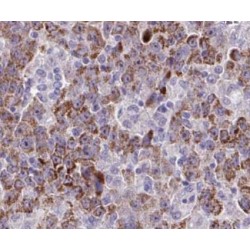 Tropomodulin-4 (TMOD4) Antibody