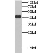 WB analysis of mouse skeletal muscle tissue, using TMOD4 antibody (1/1000 dilution).