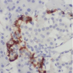 Transmembrane Emp24 Domain-Containing Protein 10 (TMED10) Antibody