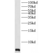WB analysis of human skeletal muscle tissue, using TMSB4X antibody (1/2000 dilution).