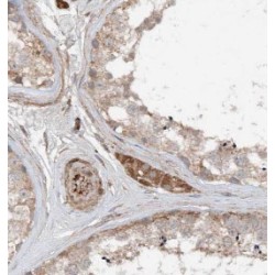 Thioredoxin Related Transmembrane Protein 3 (TMX3) Antibody